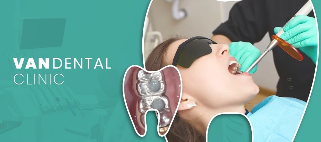 Van Dental Clinic