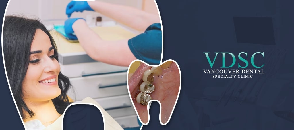 Vancouver Dental Specialty Clinic